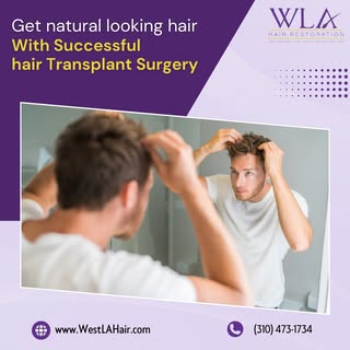 🌟 "Get Natural-Looking Hair with a Successful Hair Transplant.
Say goodbye to hair loss and hello t