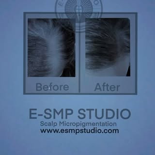 🎖️🏆Certification  SMP  course in scalp society in 
United States CA
🎖️🏆Certification 3D Line Tat