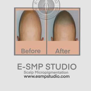 🎖️🏆Certification  SMP  course in scalp society in 
United States CA
🎖️🏆Certification 3D Line Tat