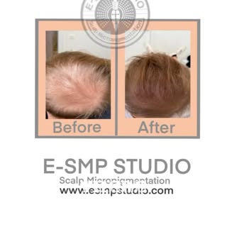🎖️🏆Certification  SMP  course in scalp society in 
United States CA
🎖️🏆Certification 3D Line Tat