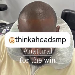 SMP #scalpmicropigmentation is the #best #hairloss solution and we are the #best at what we do @thin