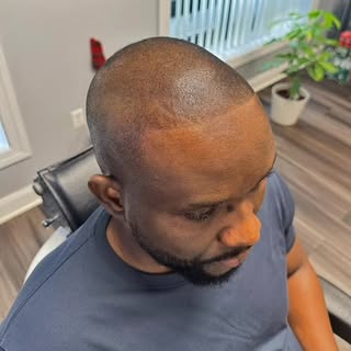 💡 Why SMP for Dark Skin?
1. Custom Pigments: We use high-quality pigments that are specifically for