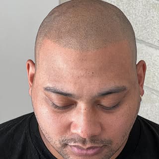 Wow . Just wow!! Realism!! #smp 
#scalptattoo #scalp #browart #browmapping #browboss #bmorebarber #p