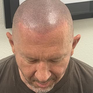Client recommended a soft widows peak