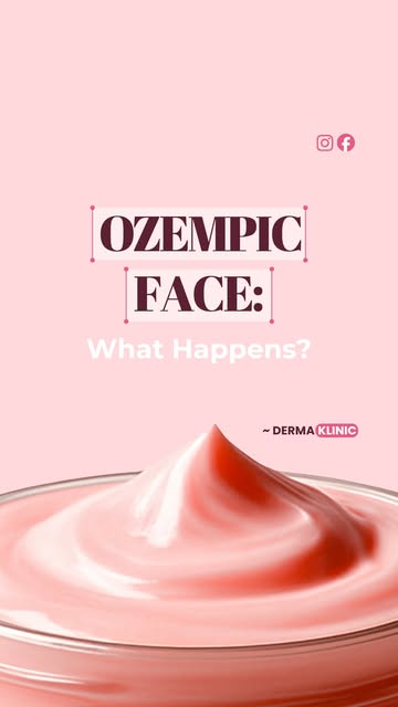 Ozempic Face: What’s Really Happening?

Rapid weight loss can sometimes lead to noticeable changes i