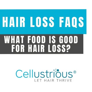 🥑✨ Want to know what food is good for hair loss? Check out these top picks to keep your locks healt