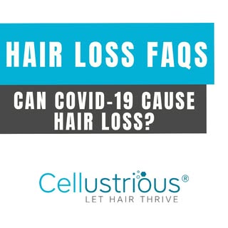 Most Frequent Hair Loss Questions! Can COVID-19 cause hair loss?  Let's dive into the facts and what