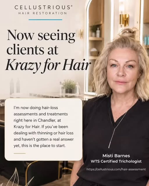 Now seeing clients at Krazy for Hair in Chandler! If you're dealing with thinning or hair loss and w