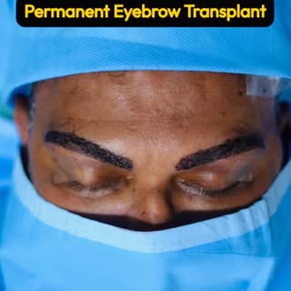 ✨ Natural-Looking Eyebrows, Designed for You! ✨

A glimpse of the results just 24 hours after Perman