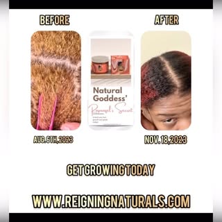 We are Hair Growth👑”The Growth is in the Pudding” Purchase today(Link in bio)
👑All Natural
👑Stimu