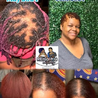 We thank God for the gift He gave us to grow hair through our glorious products. Another great #test