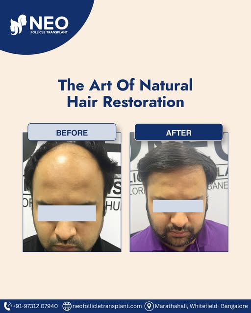 The art of natural hair restoration begins with precision, planning, and understanding what suits yo
