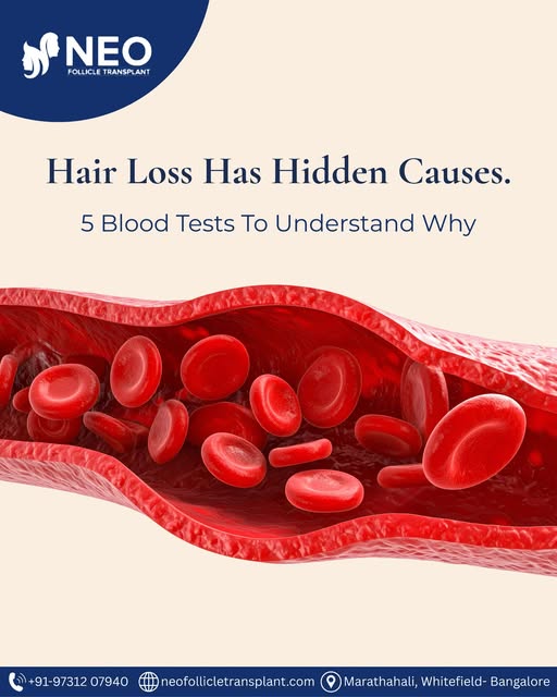 Hair fall isn’t always just about your hair.

Sometimes, the reason starts beneath the surface. Nutr