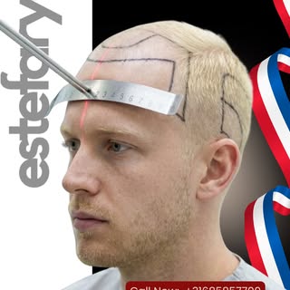 The hairline is not just a detail. it’s the frame of your face.

Rediscover your confidence with per