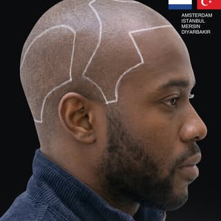 Afro hair requires a specialized approach due to its curly structure and the curved shape of hair fo
