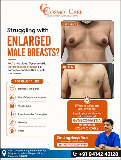 Gynecomastia Treatment in Jaipur | Male Breast Reduction Surgery

Enlarged male breasts, commonly kn