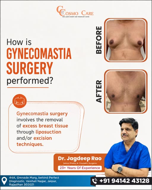 How is Gynecomastia Surgery Performed? | Gynecomastia Treatment in Jaipur

Gynecomastia, commonly kn