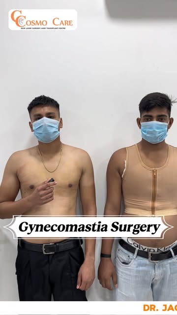 5 Days & 1 Week After Gynecomastia Surgery — Real Patient Experience 💬

दो patients ने Gynecomastia