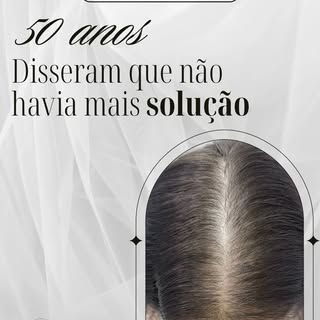 Essa paciente havia sido informada de que a perda capilar era “da idade” e que não havia mais soluçã