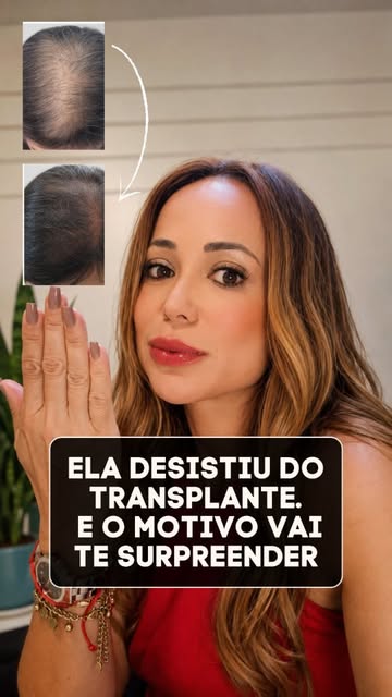 É possível evitar a cirurgia com um tratamento menos invasivo para queda de cabelo?

Sim, quando a r