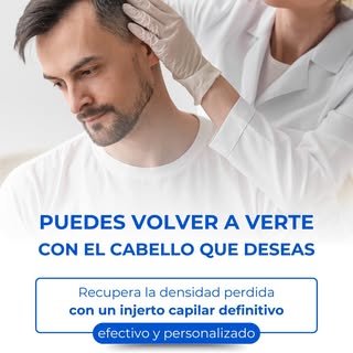 Recupera tu imagen y tu confianza con nuestro tratamiento de injerto capilar en Madrid. Resultados n