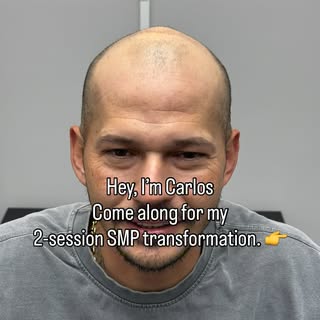 Want your hairline back?

Comment “𝗖𝗢𝗡𝗦𝗨𝗟𝗧𝗔𝗧𝗜𝗢𝗡” to learn more.

📞 (929) 209-2291

📍 1