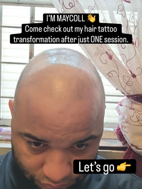 𝗢𝗡𝗘 𝗦𝗘𝗦𝗦𝗜𝗢𝗡. 𝗦𝗘𝗩𝗘𝗡 𝗪𝗘𝗘𝗞𝗦 𝗛𝗘𝗔𝗟𝗘𝗗. 👀

Most of our clients come back for the