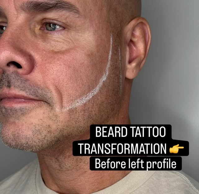 Want your beard back?

Comment “CONSULTATION” to learn more.

📞 (929) 209-2291

📍 188-08 Jamaica A