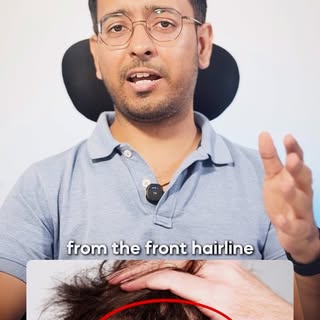 You’re Losing Hair in the WRONG Place! Hair Transplant Surgeon Explains... 

Think baldness starts f