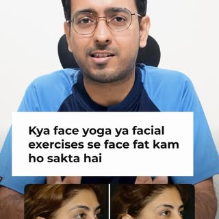 Can face yoga replace a facelift? Plastic surgeon reveals the TRUTH! #facelift #faceyoga #cosmeticsu