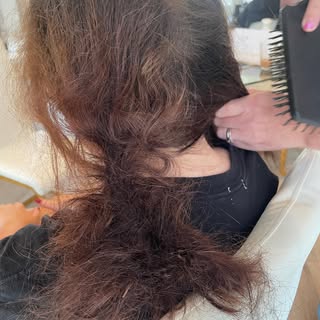 👤POST COVID HAIR LOSS👤

See next post for how we helped at @trichologyhouse 

#hairloss #alopecia 
