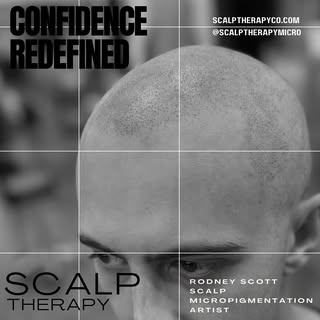 🌟 Transform Your Look with Scalp Micropigmentation  with 5 🌟rated artist 😎 

Are you ready to reg