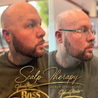 FMP (Facial Micropigmentation) for the win 🏆 

This gentleman wanted to fill in some patchy beard a