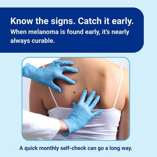 It’s Melanoma Monday—and we’re using it to kick off awareness week. 

When caught early, the surviva