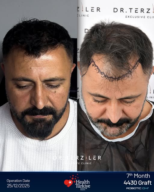 Görsel gerçek hastaya aittir; Görsel İçerik Kaydetme ve İşleme Onam Formu ile açık rızası alınmıştır