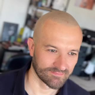 SMP - mikropigmentácia vlasových folikúl - u nás kladieme dôraz na prirodzenosť 👌🏼

📌 objednaj sa