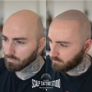 Nice & clean SMP result⚡️

#naturalresults 

…nezabudni sa ozvať čo najskôr, teraz do konca apríla m