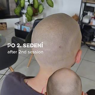 A subtle enhacement that restores self-confidence 😎🍀

Jemné vylepšenie, ktoré vracia aj sebavedomi