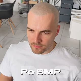„Nie je to filter. Je to zmena, ktorá ti vráti sebavedomie. 🔥
Mikropigmentácia vlasov (SMP)– prirod