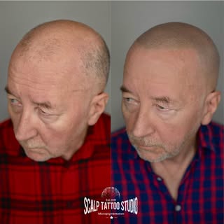 „Vek nerozhoduje. Sebavedomie áno. ✨
Mikropigmentácia vlasov je prirodzené riešenie pre každého muža