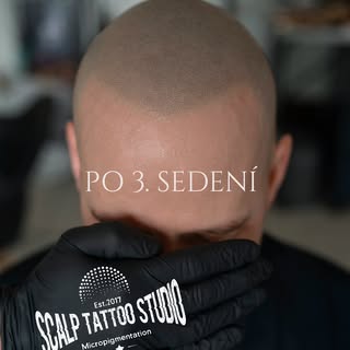 Každé ukončené sedenie SMP je ďalší krok k väčšiemu sebavedomiu. ✨

Prirodzený výsledok, čistý detai