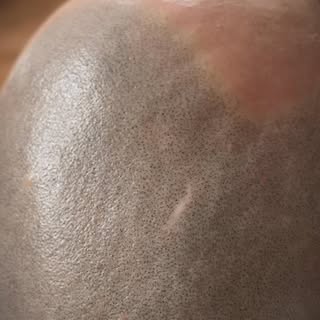 Nice & clean SMP result⚡️

#naturalresults 

…nezabudni sa ozvať čo najskôr, teraz do konca apríla m