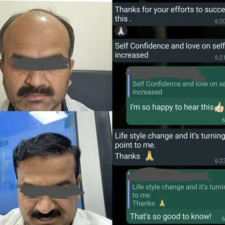 The joy of being a hair transplant surgeon