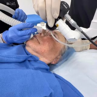 Walking you through an upper lid Blepharoplasty and co2 laser resurfacing #co2laser #blepharoplasty