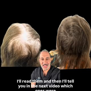 Nine months. One prescription. Zero devices, zero injections, zero “hair growth gummies.”
Before you