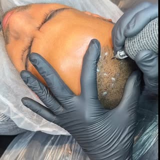 FULLER. THICKER. CONFIDENT.

Struggling with thinning hair or visible scalp?
Male Density SMP is des
