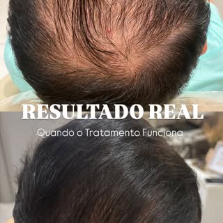 Quando o tratamento é individualizado, o resultado aparece — e às vezes mais rápido do que você imag