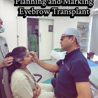 ✨ Long-Hair Eyebrow Transplant: Where Precision Meets Artistry ✨
Achieving natural-looking eyebrows 