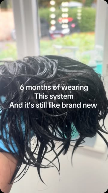 get excited every time my clients come back for a removal and refit 🤍

My client has had this syste