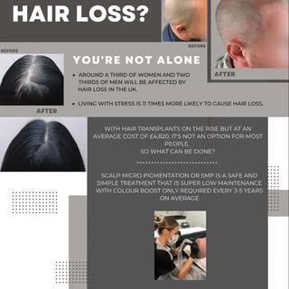 Scalp Micro pigmentation Information

#hairloss #smp

#information #smp #scalp #scalpmicropigmentati